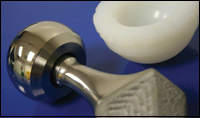 Hip replacement orthopedics, image courtesy Texas A & M Engineer Magazine.